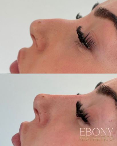 Ebony Aesthetics 29 Medium